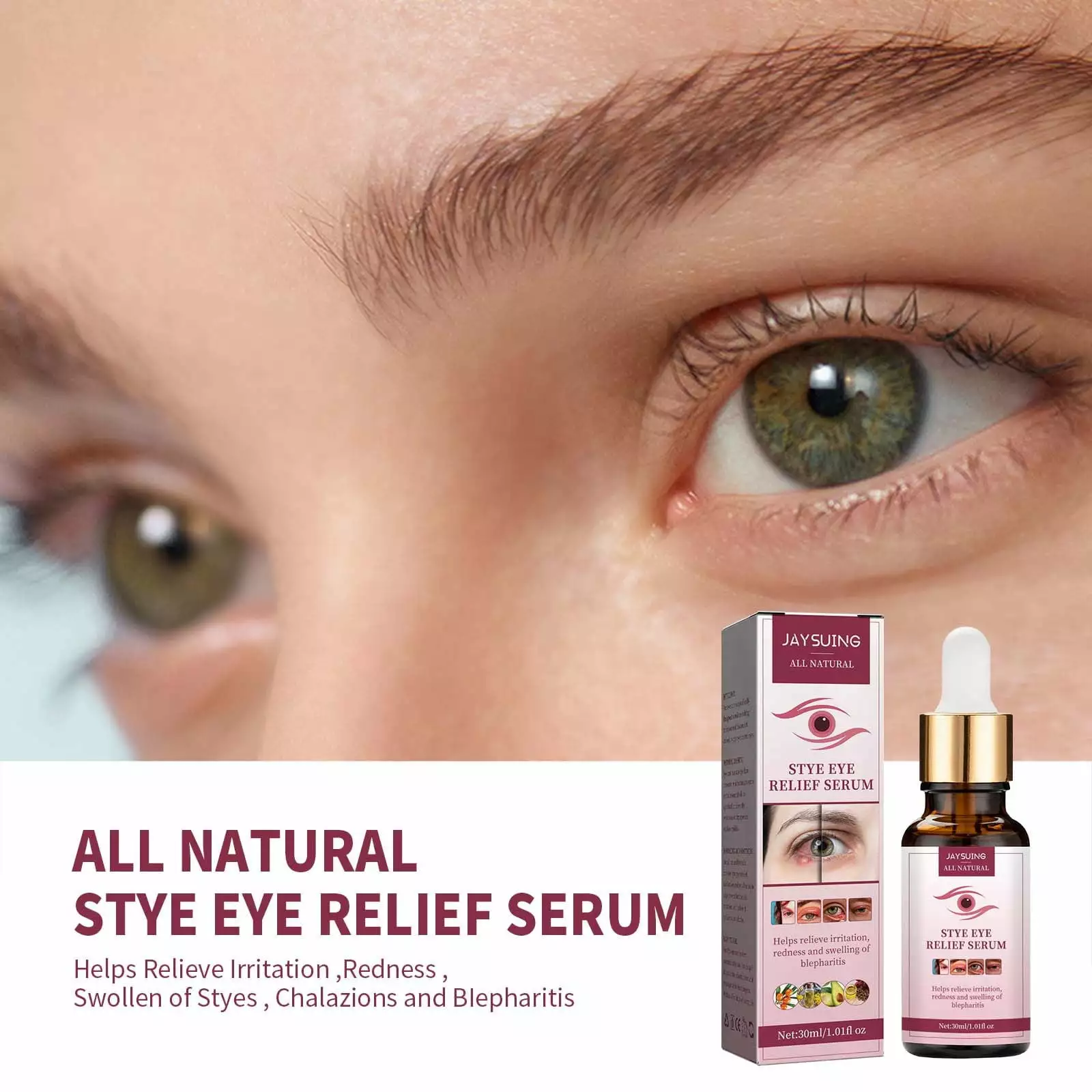 Gzwccvsn Stye Soothing Eye Serum Relieves Eye Infections Blepharitis And Blepharitis 30ml